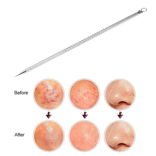 1 Pice De Dissolvant D'acn De Points Noirs En Acier Inoxydable, Outil D'aiguilles De Nettoyage De Visage Pour Dissolvant De Soins Du Visage Tslm2