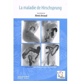 La Maladie De Hirschsprung