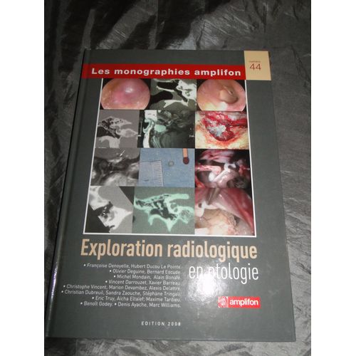 Les Monographies Amplifon Exploration Radiologique En Otologie N° 44