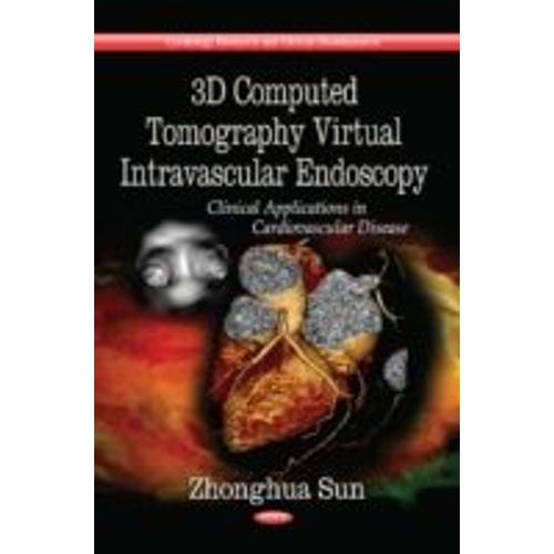 3d Computed Tomography Virtual Intravascular Endoscopy