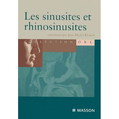 Les Sinusites Et Les Rhinosinusites