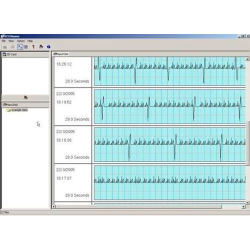 Omron Logiciel Pour Scanner Du Coeur Pack D'extension (Sans Moniteur Ecg, Juste Le Programme)