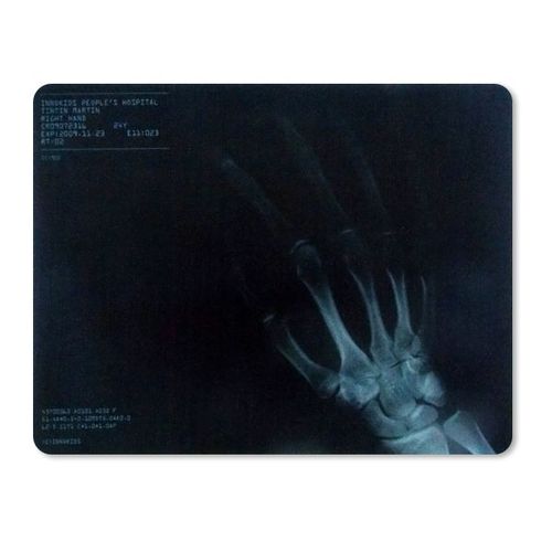 Tapis de souris informatique radiographie main