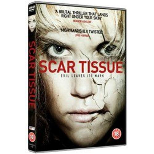 Scar Tissue