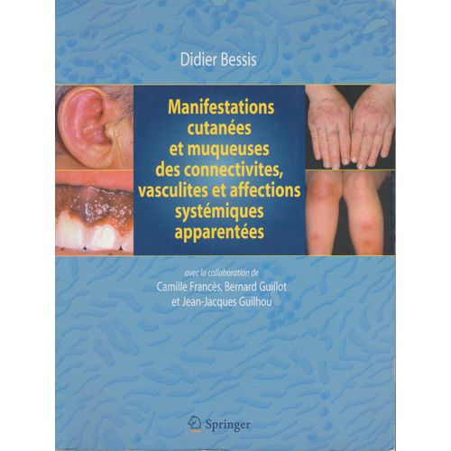 Manifestations Cutanées Et Muqueuses Des Connectivites, Vasculites Et Affections Systémiques Apparentées : Dermatologie Et Médecine, Vol. 1