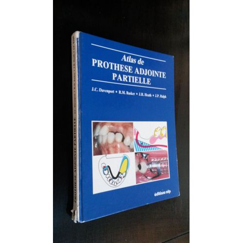 Atlas De Prothese Adjointe Partielle 