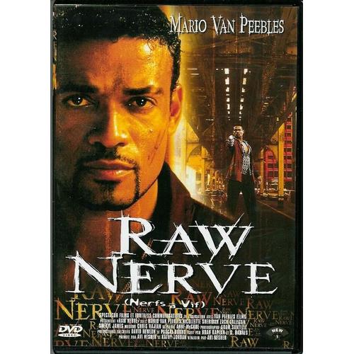 Raw Nerve