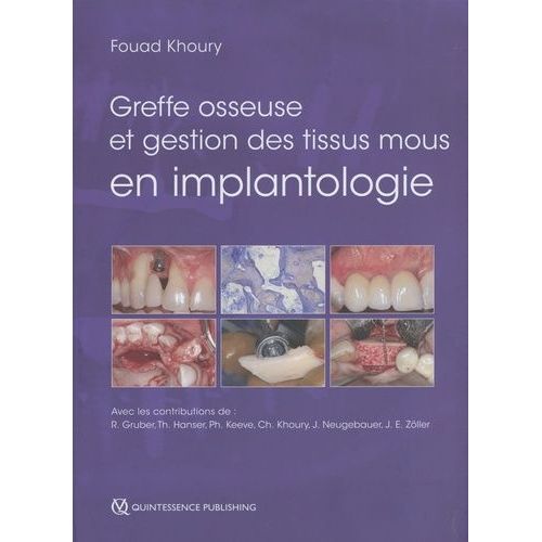 Greffe Osseuse Et Gestion Des Tissus Mous En Implantologie