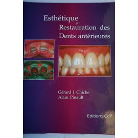 Esthétique Et Restauration Des Dents Antérieures