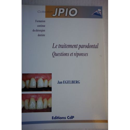 Le Traitement Parodontal - Questions Et Réponses