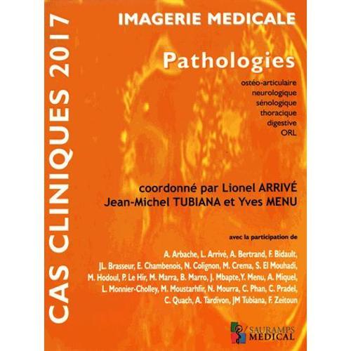Imagerie Médicale - Pathologies Ostéoarticulaire, Neurologique, Sénologique, Thoracique, Digestive, Orl