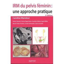 Irm Du Pelvis Féminin : Une Approche Pratique