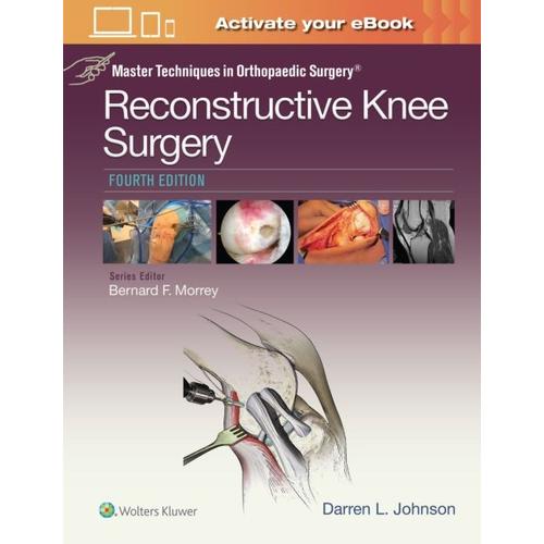 Master Techniques In Orthopaedic Surgery: Reconstructive Kne