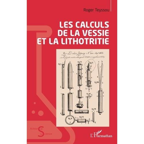 Les Calculs De La Vessie Et La Lithotritie