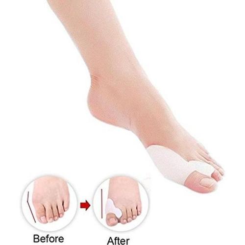 Dr.Pedi Gel Toe Bunion Correcteur S¿¿Parateurs Hallux Valgus Pro Toe Stretchers Bunion Straightener Alignement (1 Paire): Beauté Multicolore