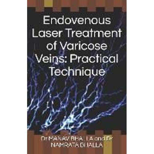 Endovenous Laser Treatment Of Varicose Veins: Practical Technique