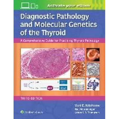 Diagnostic Pathology And Molecular Genetics Of The Thyroid - A Comprehensive Guide For Practicing Thyroid Pathology