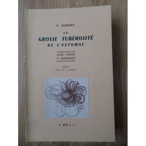 La Grosse Tubérosité De L'estomac Normale Et Pathologique - Etude Clinique Et Radiologique