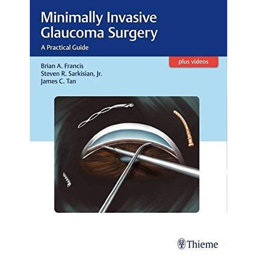Minimally Invasive Glaucoma Surgery