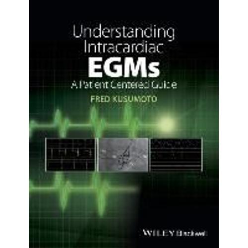 Understanding Intracardiac Egms