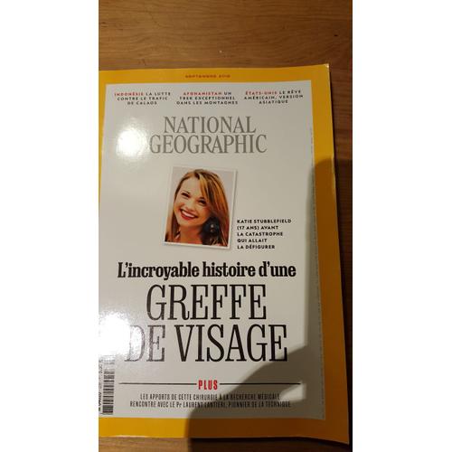 National Geographic Greffe De Visage