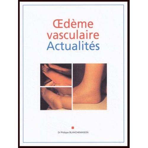 Oedème Vasculaire Actualités