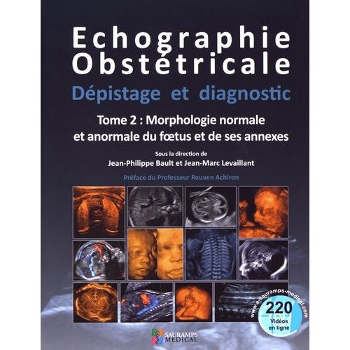 Echographie Obstétricale, Dépistage Et Diagnostic - Tome 2, Morphologie Normale Et Anormale Du Foetus Et De Ses Annexes