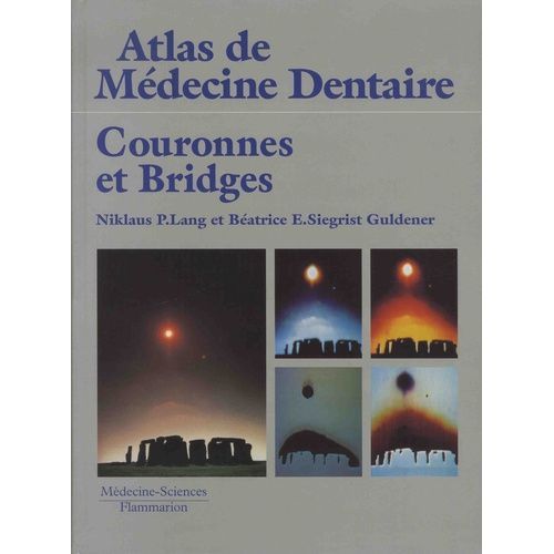Couronnes Et Bridges
