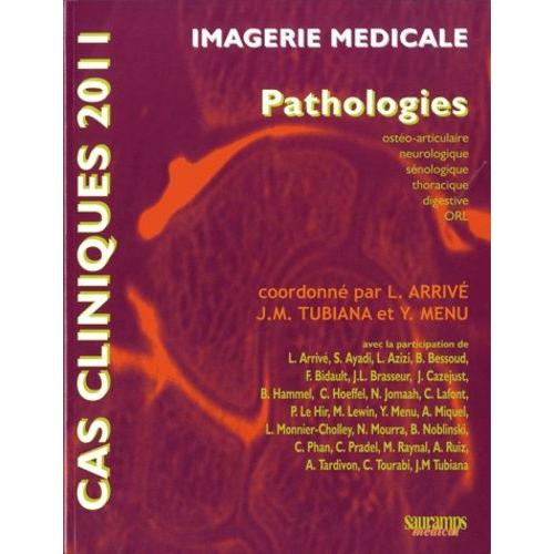 Imagerie Médicale - Pathologies