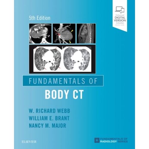 Fundamentals Of Body Ct