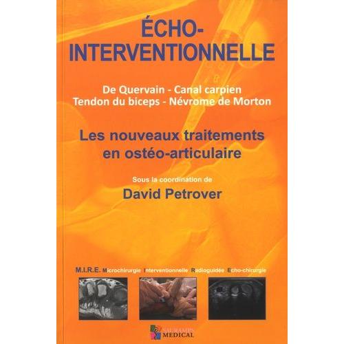 Echo-Interventionnelle - Les Nouveaux Traitements En Ostéo-Articulaire - De Quervain, Canal Carpien, Tendon Du Biceps, Névrome De Morton
