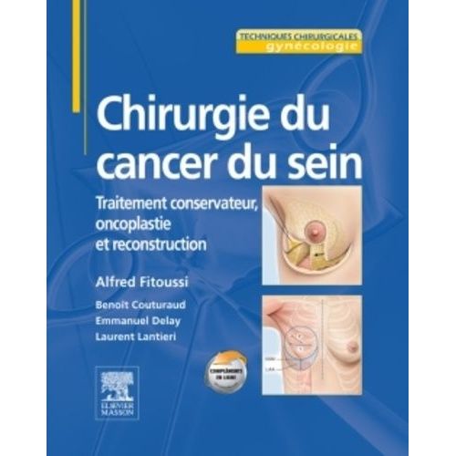 Chirurgie Du Cancer Du Sein