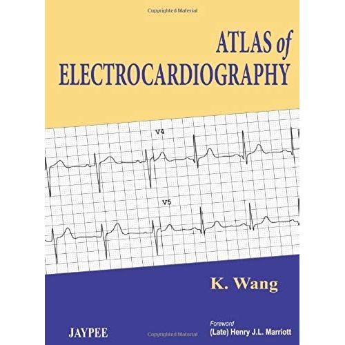 Atlas Of Electrocardiography