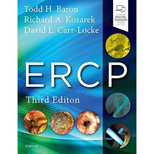 Ercp
