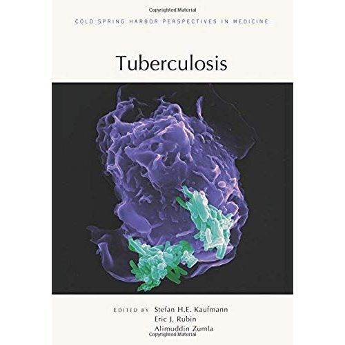 Tuberculosis