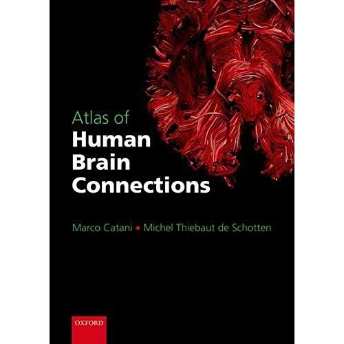 Atlas Of Human Brain Connections