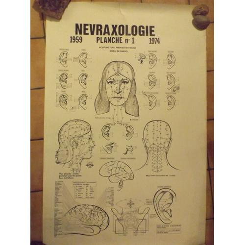 Planche 1 Tête Nevraxologie Acupunture Phenixotantrique Boris De Bardot 1974