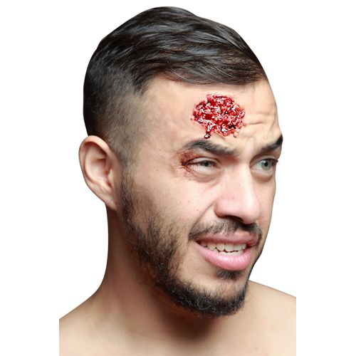Fausse Plaie Infectée