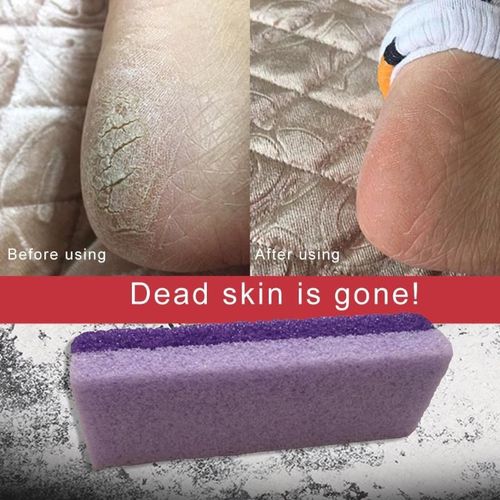 Pierre Ponce Chaude Exfolier Pied Pieds Soin Peau Seche Morte Calus Pedicure Peau Gommage Callosites Dissolvant Epurateur Outil Livraison Directe 