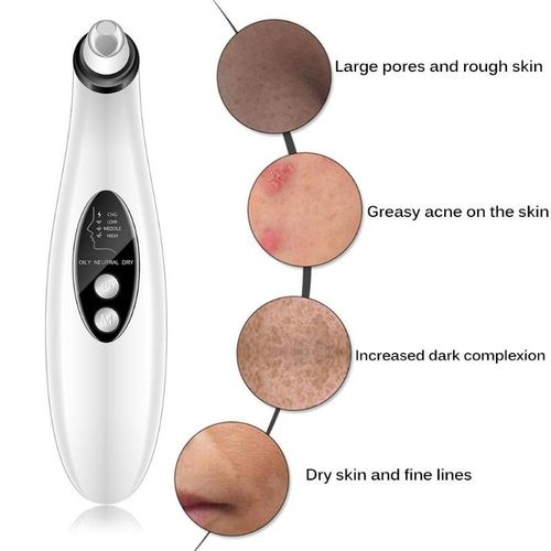 Nouvel Instrument De Nettoyage De Visage De Beaute Electrique Dissolvant De Points Noirs Soins De La Peau Pores Acne Bouton Enlevement Aspiration Visage Propre 