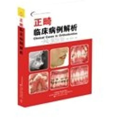 Orthodontic Clinical Cases Resolved(Chinese Edition)