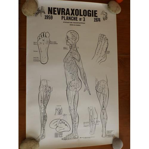 Planche 3 Nevraxologie Acupuncture Phenixotantrique Boris De Bardot 1974