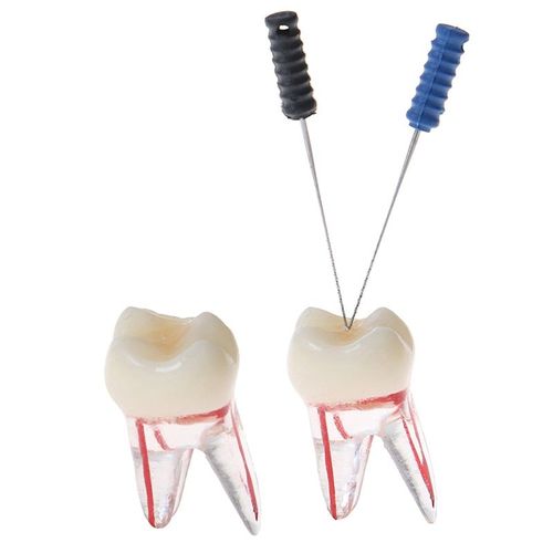 Offre Spéciale 1:1 Résine Endodontique Dentaire Étudiant Étude Modèle De Pratique Avec Canal Radiculaire Coloré Et Pulpe Transparente Sans Fichiers
