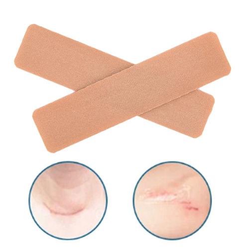 Xm 2 Pièces/Lot Patchs Silicone Gel Cicatrice Loin Thérapie Plaie Cicatrice Pâte Enlèvement Césarienne Section Hypertrophique Keloïde Cicatrice Enlèvement 