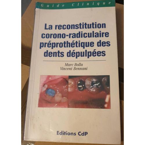 La Reconstitution Coron-Radiculaire Préprothétique Des Dents Dépulpées, Marc Bolla, Vincent Bennani
