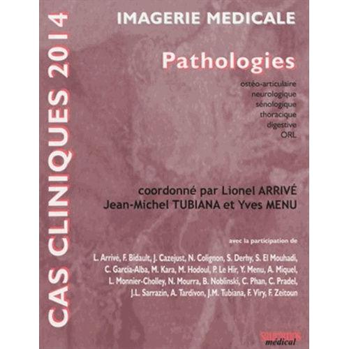 Imagerie Médicale - Pathologies Ostéo-Articulaire, Neurologique, Sénologique, Thoracique, Digestive, Orl