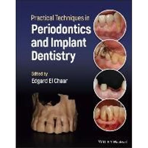 Practical Techniques In Periodontics And Implant Dentistry