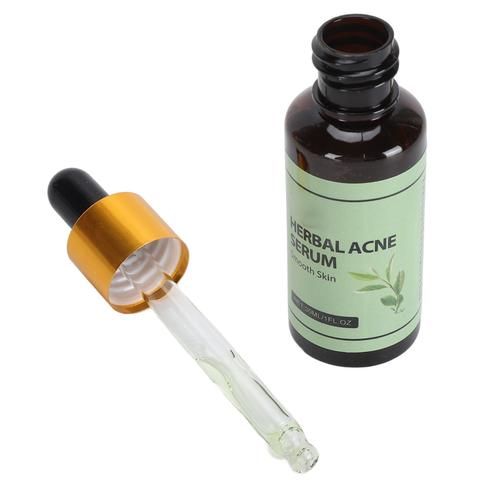 SéRum Anti-Boutons Pour Le Visage, Hydratant En Profondeur, ContrôLe De L'huile, SéChage Rapide, RéTréCissement Doux Des Pores, Pour Soins De La Peau, 30ml, 2 PièCes