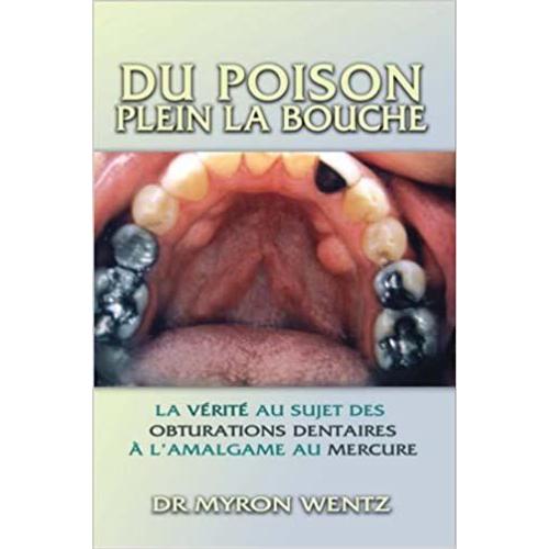 Du Poison Plein La Bouche, La Vérité Au Sujet Des Obturatons Dentaires À L'amalgame Au Mercure