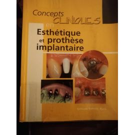 Concepts Cliniques En Esthétique Et Prothèse Implantaire, L'essentiel De Stratégie Prothétique